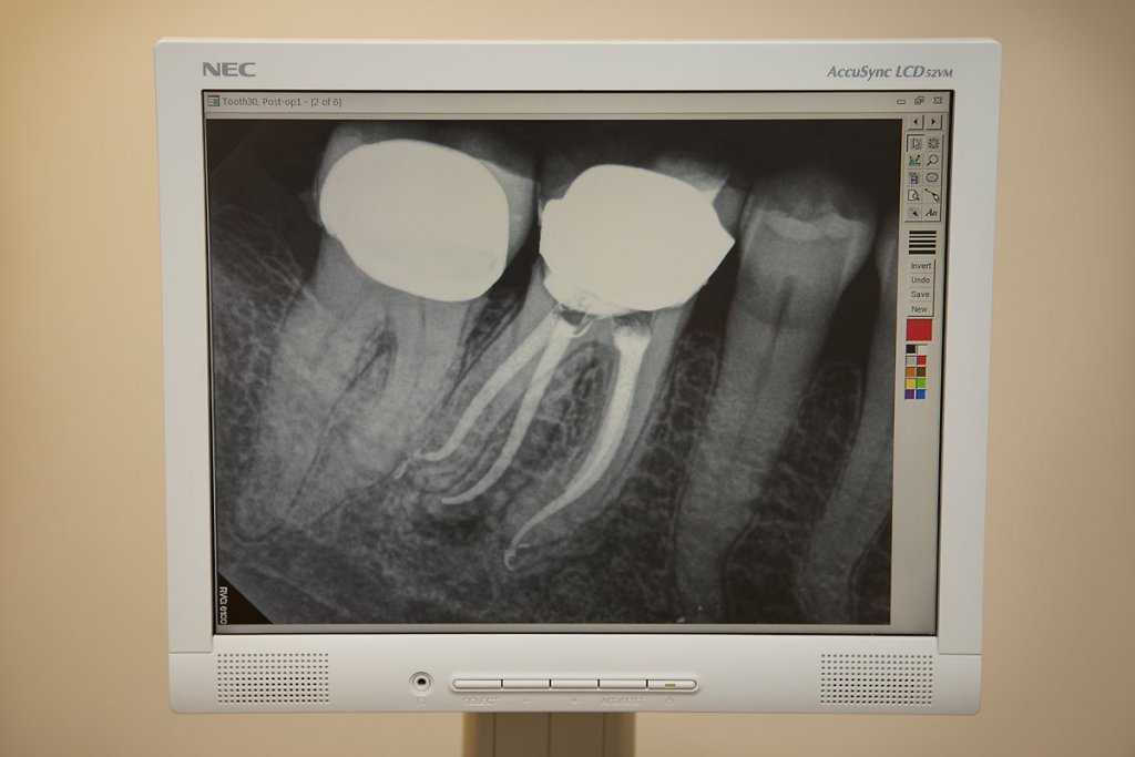 xray on screen